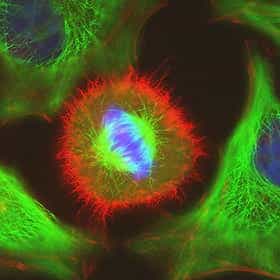 Cell images of interphase and mitosis